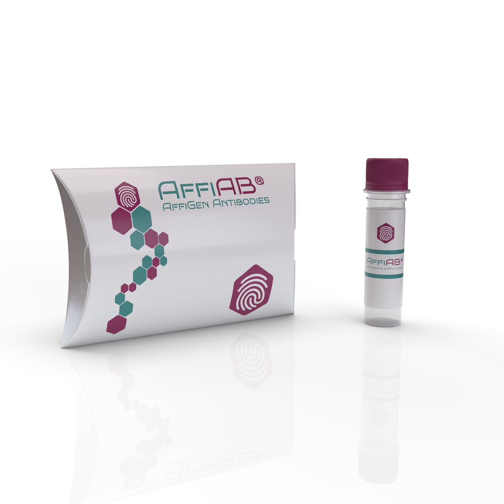 [AFG-KMY-0062] AffiAB®​ BCMA (mouse) Antibody [Vicky-2]
